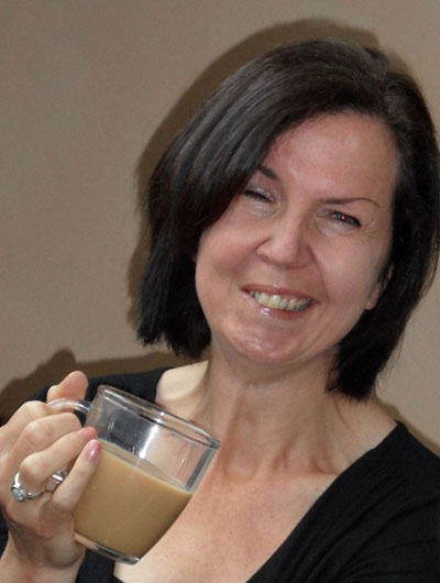 Nicola has been left with synkinesis